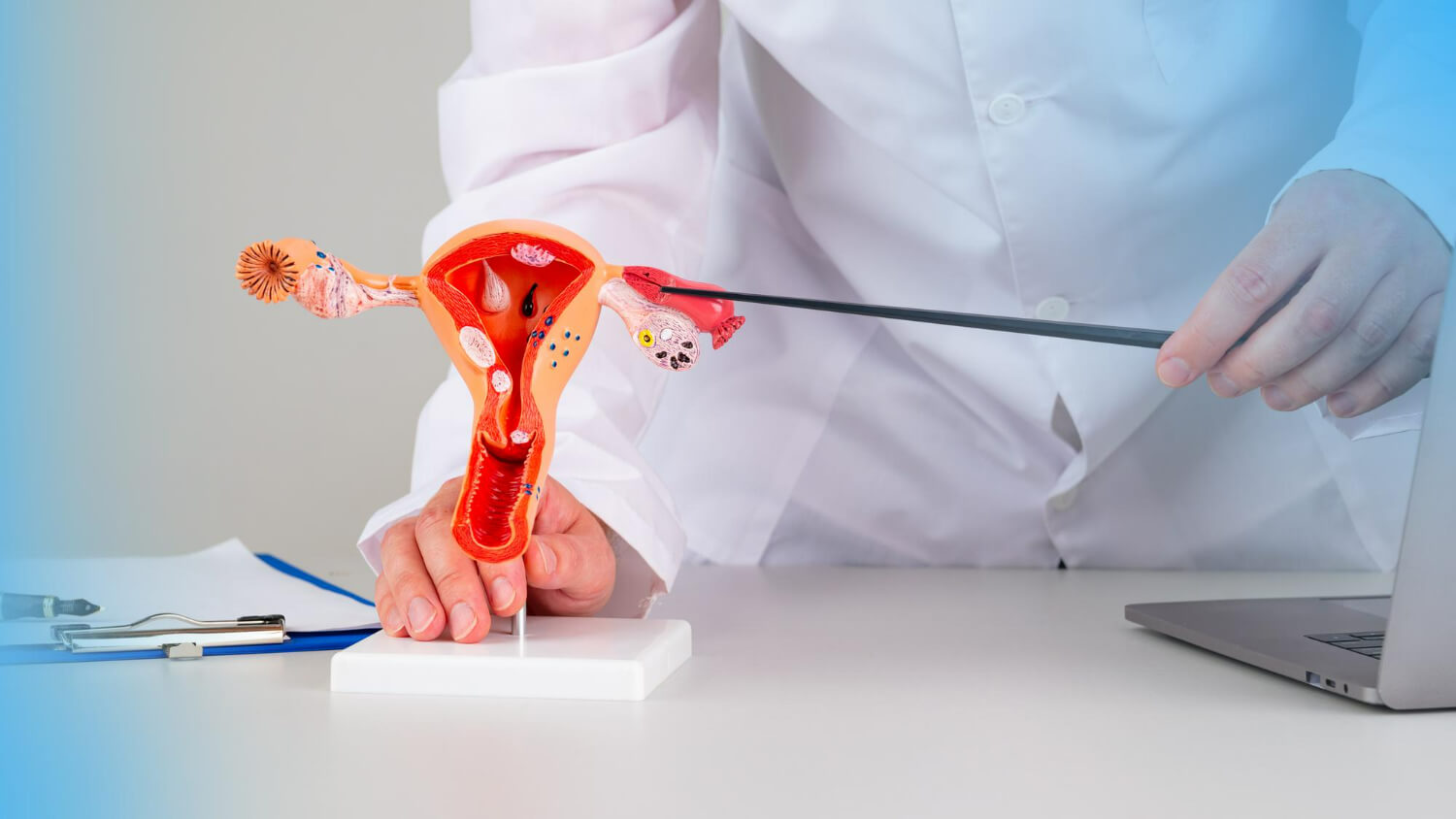 ce este sindromul ovarelor polichistice ce este sindromul ovarelor polichistice