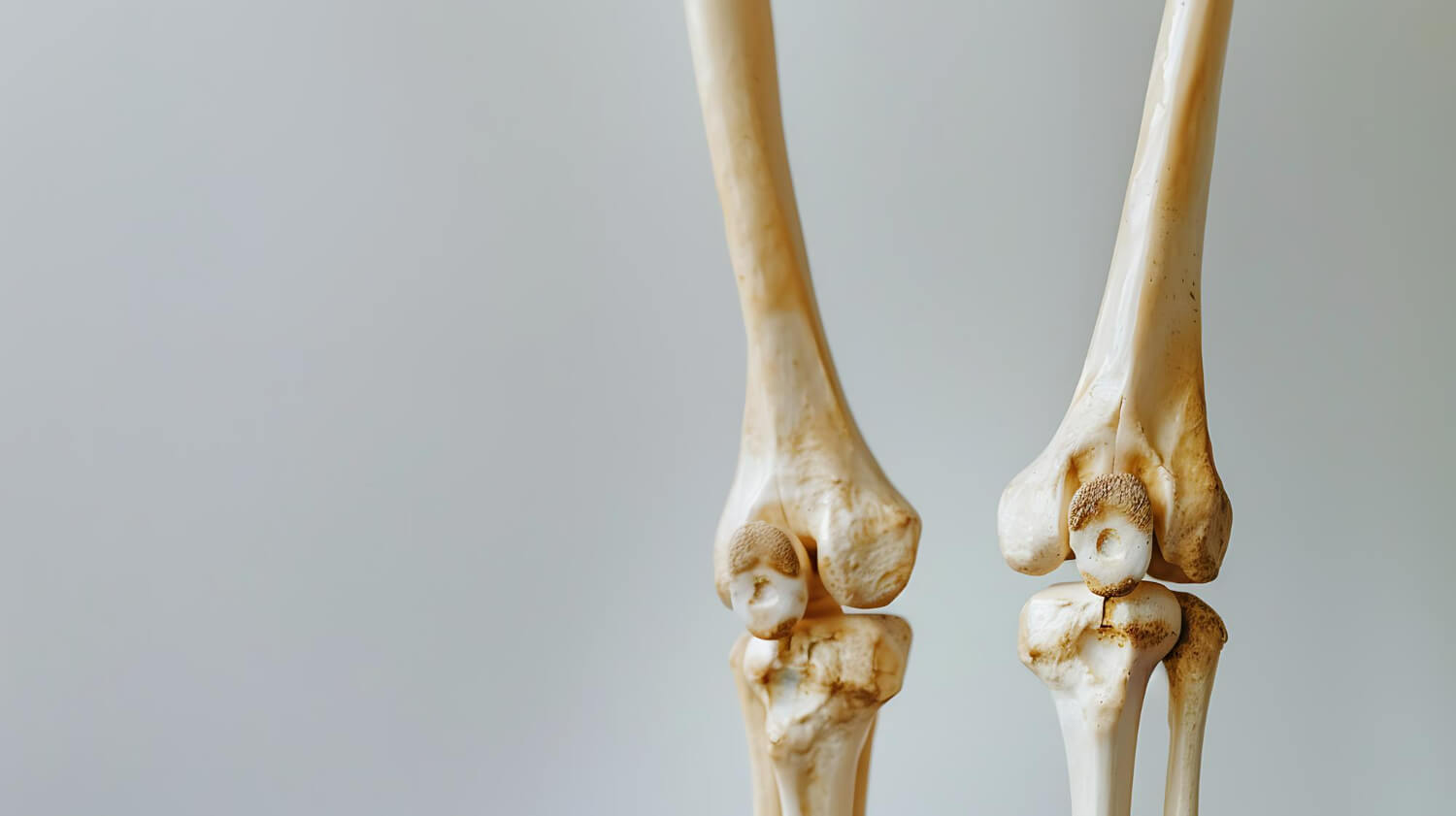 cauze osteoporoza cauze osteoporoza